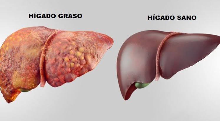 Imagen del artículo